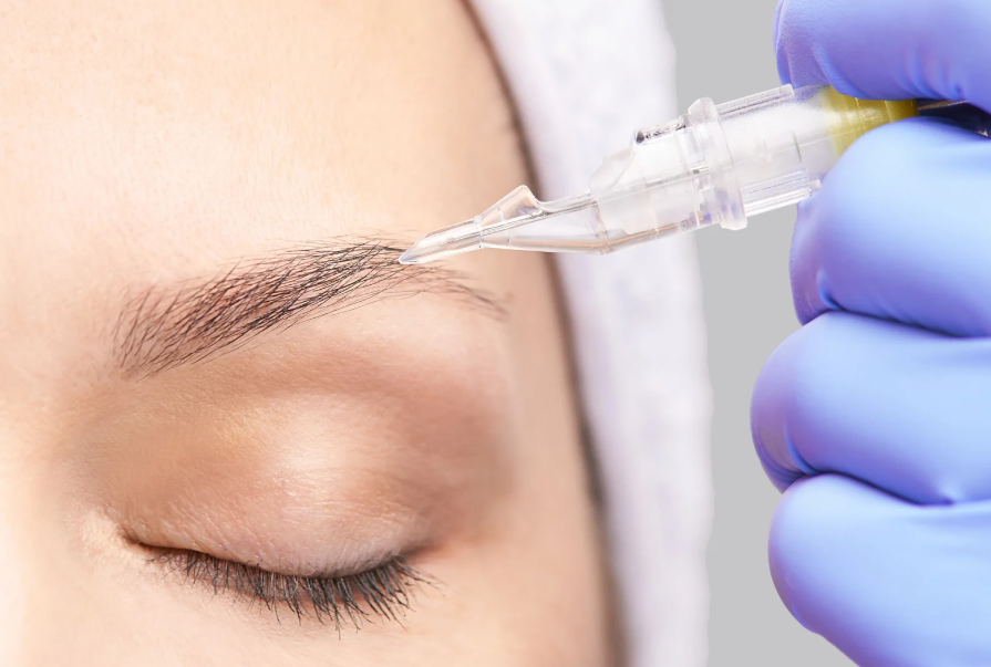 עיצוב גבות בשיטת השערה